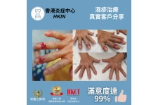 香港炎症中心_真實客戶分享_濕疹治療6_(2)